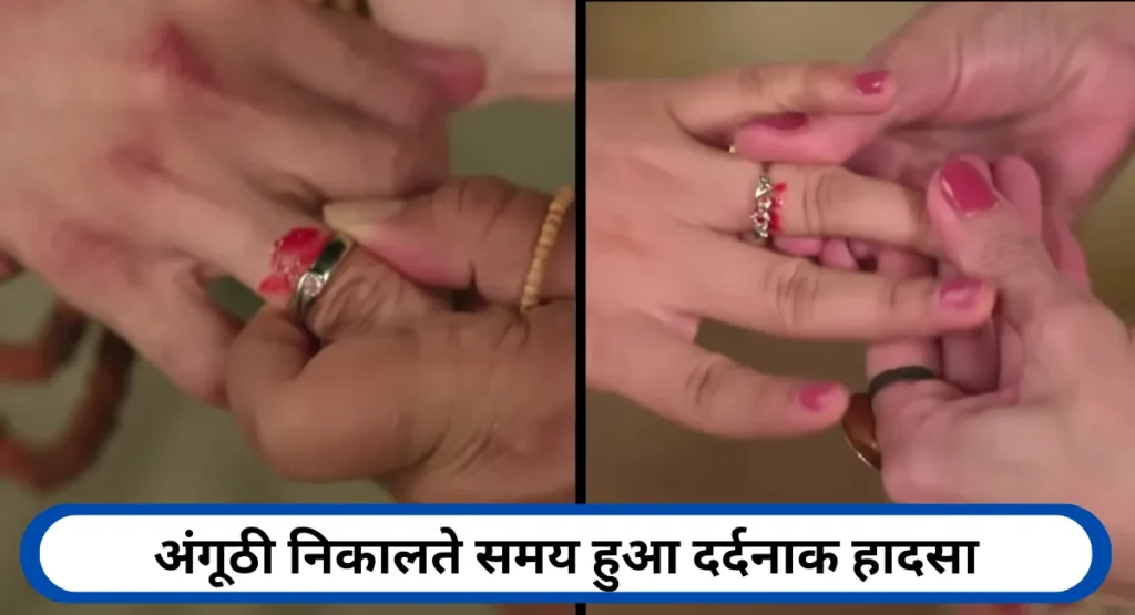 अंगूठी निकालते समय हुआ दर्दनाक हादसा